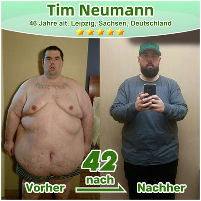 🔥Offizieller deutscher Shop 🇩🇪 | Geelemon® Advanced Nano System einmal täglich pflege