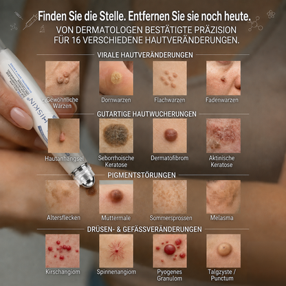HISKIN® 🧑‍⚕️ 7-Tage- Hautanhängsel- & Fleckenentferner – Fortschrittlicher Roll-on-Stift zur schmerzfreien und narbenfreien Entfernung von Hautunreinheiten